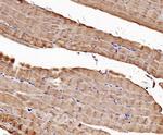 CaV1.1 Polyclonal Antibody