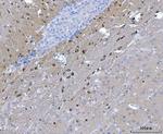 NOS1AP Polyclonal Antibody