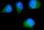 CDK5RAP2 Polyclonal Antibody