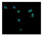 Clathrin Heavy Chain Polyclonal Antibody