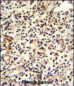 PCM1 Polyclonal Antibody