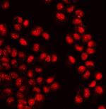 WAPL Polyclonal Antibody