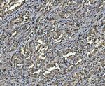 hnRNP U Antibody in Immunohistochemistry (Paraffin) (IHC (P))