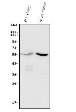 CYP11B1/CYP11B2 Polyclonal Antibody