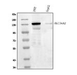 SLC34A2 Antibody in Western Blot (WB)