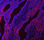 NDUFS5 Polyclonal Antibody