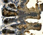Galectin 2 Antibody in Immunohistochemistry (Paraffin) (IHC (P))