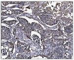 ERAP2 Polyclonal Antibody