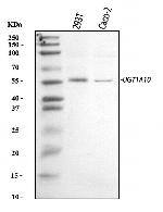 UGT1A10 Polyclonal Antibody