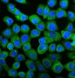 UBE2D1/2/3/4 Polyclonal Antibody