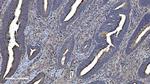CMBL Polyclonal Antibody