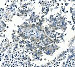 Kir6.1 (KCNJ8) Polyclonal Antibody