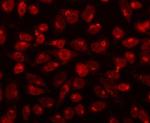 CDK13 Polyclonal Antibody
