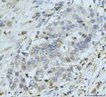 gp210 Antibody in Immunohistochemistry (Paraffin) (IHC (P))