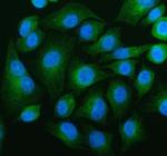 beta Tubulin Polyclonal Antibody