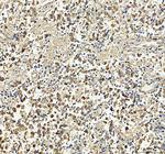 beta Tubulin Antibody in Immunohistochemistry (Paraffin) (IHC (P))