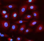 DNAJC6 Polyclonal Antibody