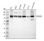 DNAJC6 Antibody in Western Blot (WB)