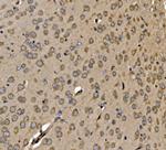 SRP72 Antibody in Immunohistochemistry (Paraffin) (IHC (P))