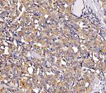 RHOT1 Antibody in Immunohistochemistry (Paraffin) (IHC (P))