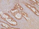 KIF15 Antibody in Immunohistochemistry (Paraffin) (IHC (P))