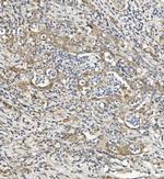 SEMA6A Polyclonal Antibody