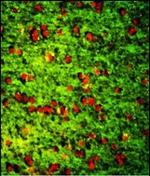 DPT Antibody in Immunohistochemistry (Paraffin) (IHC (P))