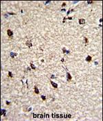 DPT Polyclonal Antibody