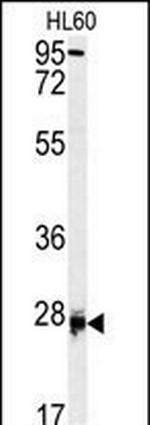 DPT Antibody in Western Blot (WB)