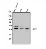 MESP2 Antibody in Western Blot (WB)
