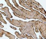 TNNI1 Polyclonal Antibody