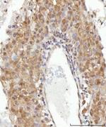 CEP250 Polyclonal Antibody