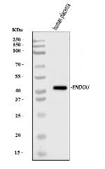 PP11 Antibody in Western Blot (WB)