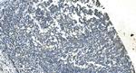 TIMM8A Antibody in Immunohistochemistry (Paraffin) (IHC (P))
