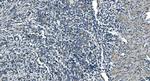 TIMM8A Antibody in Immunohistochemistry (Paraffin) (IHC (P))