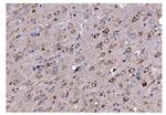 TIMM8A Antibody in Immunohistochemistry (Paraffin) (IHC (P))