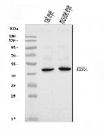 Keratocan Antibody in Western Blot (WB)