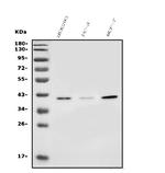 SLC25A19 Polyclonal Antibody
