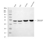 TRIP Antibody in Western Blot (WB)