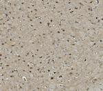 PRMT8 Antibody in Immunohistochemistry (Paraffin) (IHC (P))