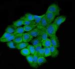 LAR4B Polyclonal Antibody