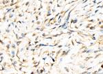 AP2A2 Antibody in Immunohistochemistry (Paraffin) (IHC (P))