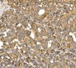 MLXIP Antibody in Immunohistochemistry (Paraffin) (IHC (P))