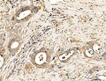 MLXIP Antibody in Immunohistochemistry (Paraffin) (IHC (P))