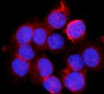 BDH1 Polyclonal Antibody