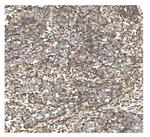 BDH1 Antibody in Immunohistochemistry (Paraffin) (IHC (P))