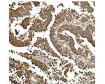 BDH1 Antibody in Immunohistochemistry (Paraffin) (IHC (P))