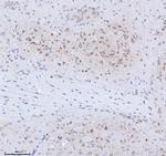 TRANK1 Antibody in Immunohistochemistry (Paraffin) (IHC (P))