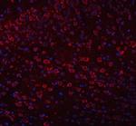 TRANK1 Antibody in Immunohistochemistry (Paraffin) (IHC (P))