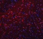 TRANK1 Antibody in Immunohistochemistry (Paraffin) (IHC (P))